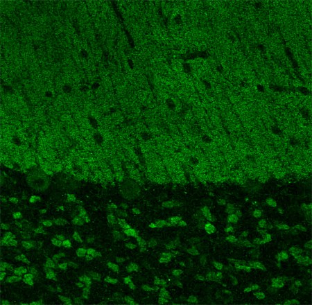 Shank3 Polyclonal rabbit antiserum - image 3