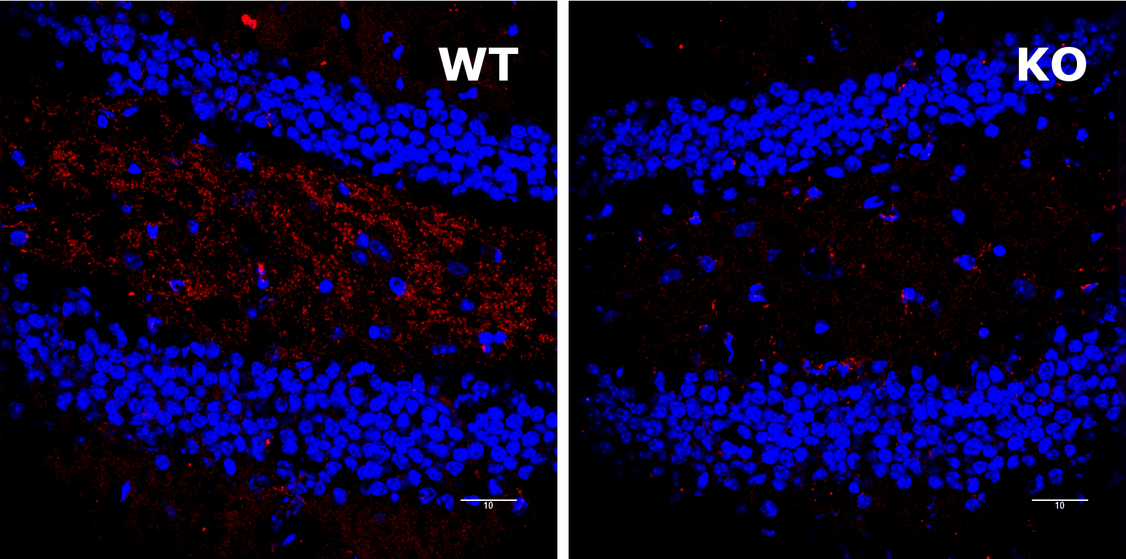 Shank3 Polyclonal rabbit antiserum - image 4