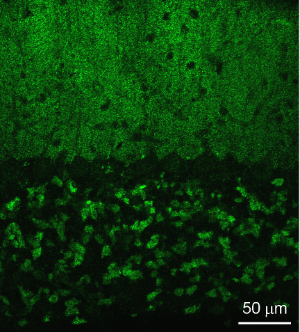 Shank3 Polyclonal Guinea pig antiserum - image 3