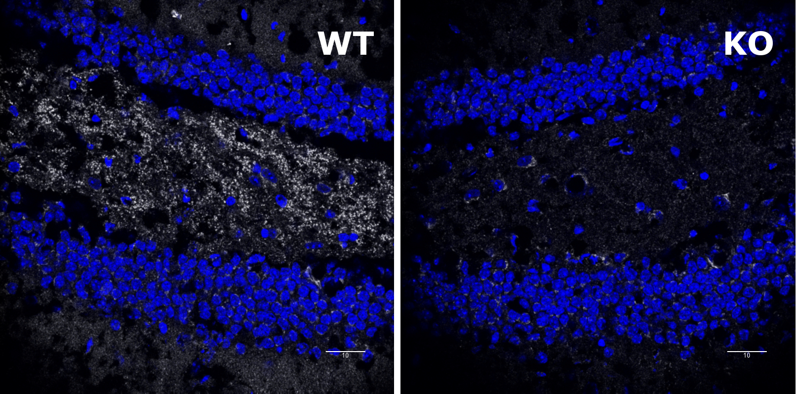 Shank3 Polyclonal Guinea pig antiserum - image 4