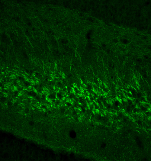 Neurofilament L Polyclonal rabbit antiserum - image 3