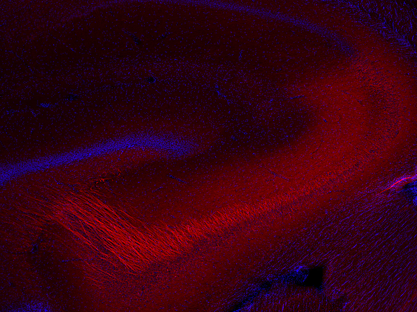 Neurofilament L Polyclonal rabbit antiserum - image 4