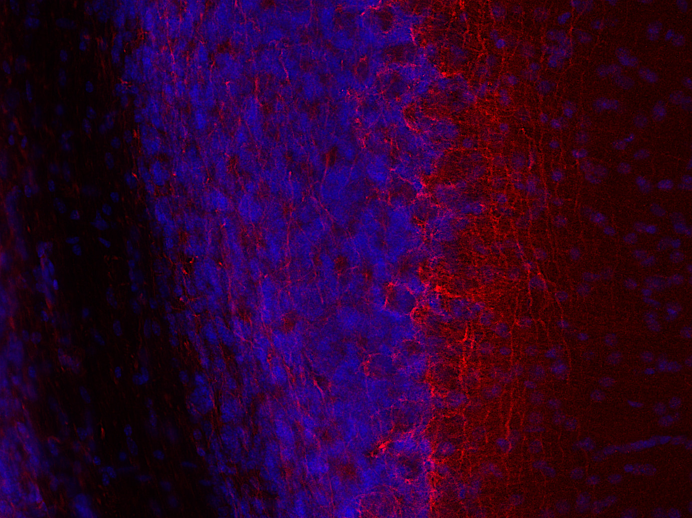 Neurofilament L Polyclonal rabbit antiserum - image 5