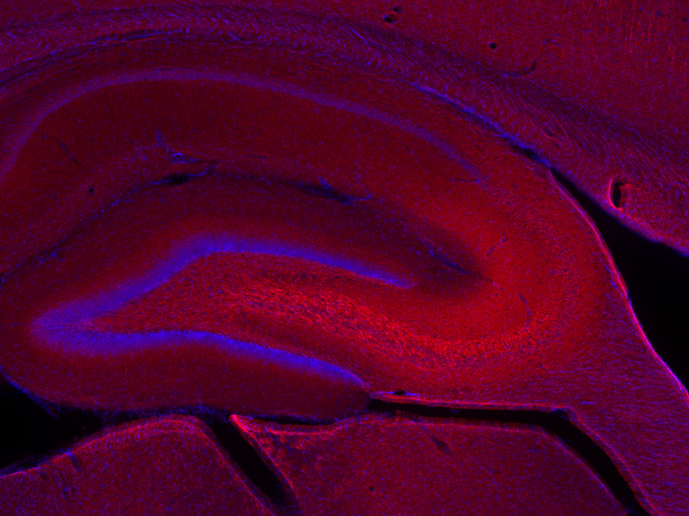 Neurofilament L Recombinant rabbit - image 4