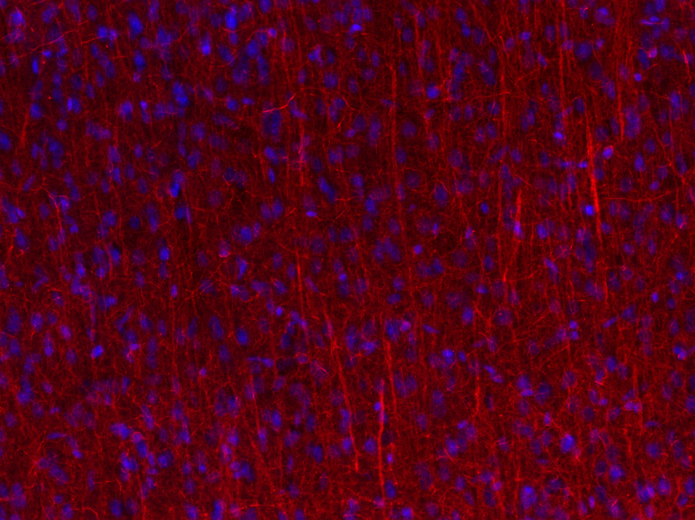 Neurofilament L Recombinant rabbit - image 5