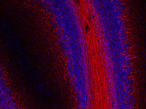 Neurofilament H Polyclonal chicken purified antibody - image 2