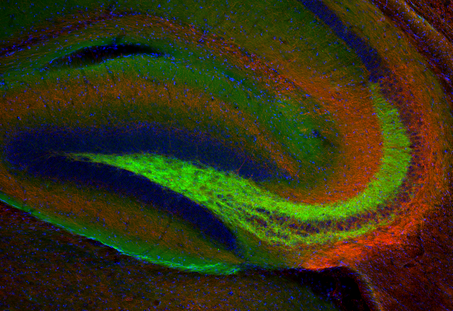 Neurofilament H Recombinant rabbit - image 4