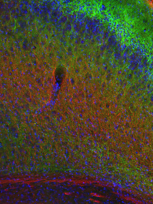 Neurofilament M Polyclonal rabbit antiserum - image 3
