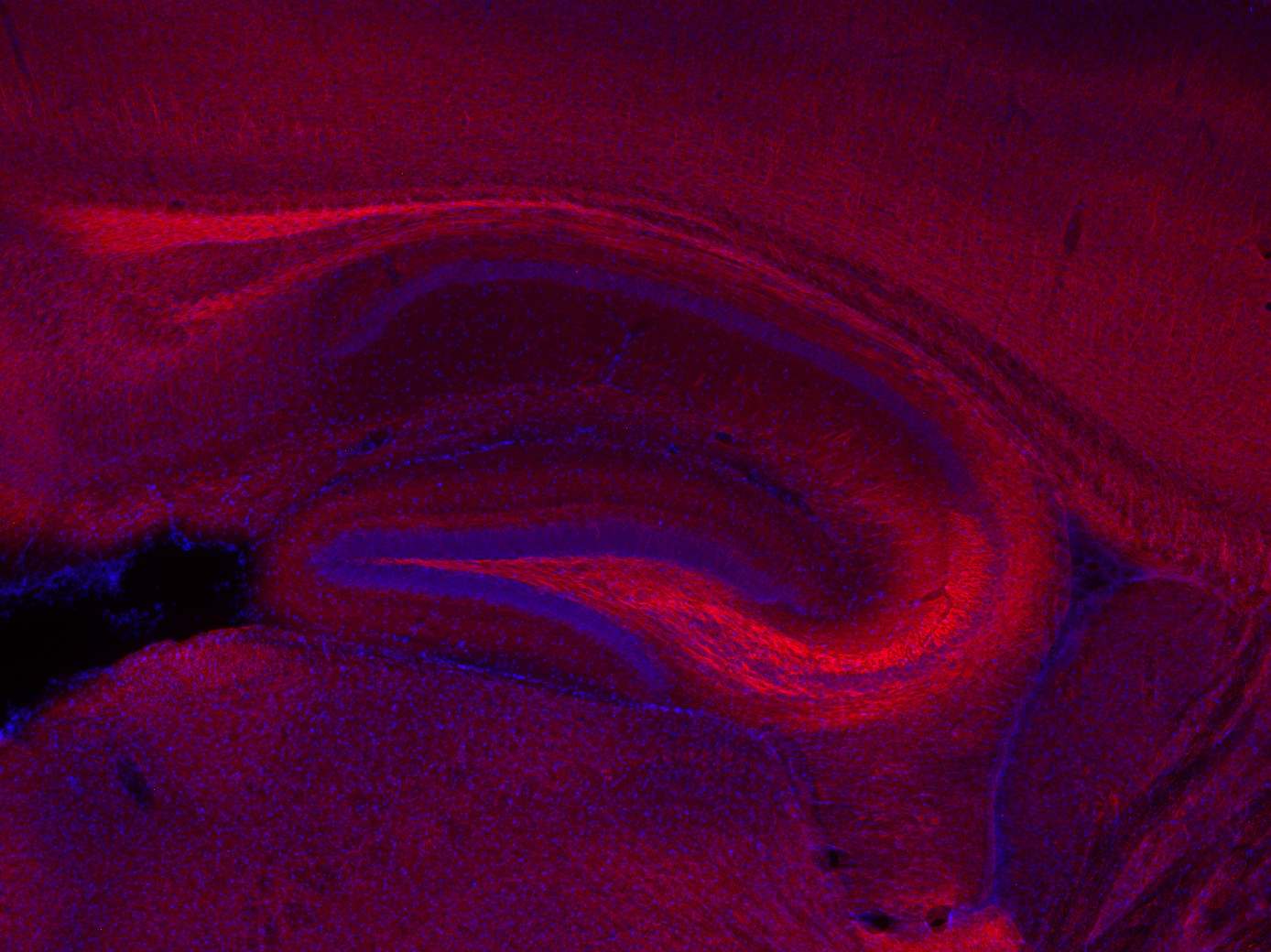 Neurofilament M Recombinant rabbit - image 3