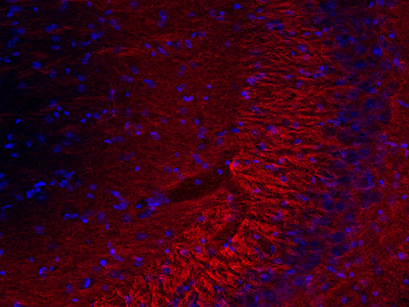 Neurofilament M Recombinant rabbit - image 4