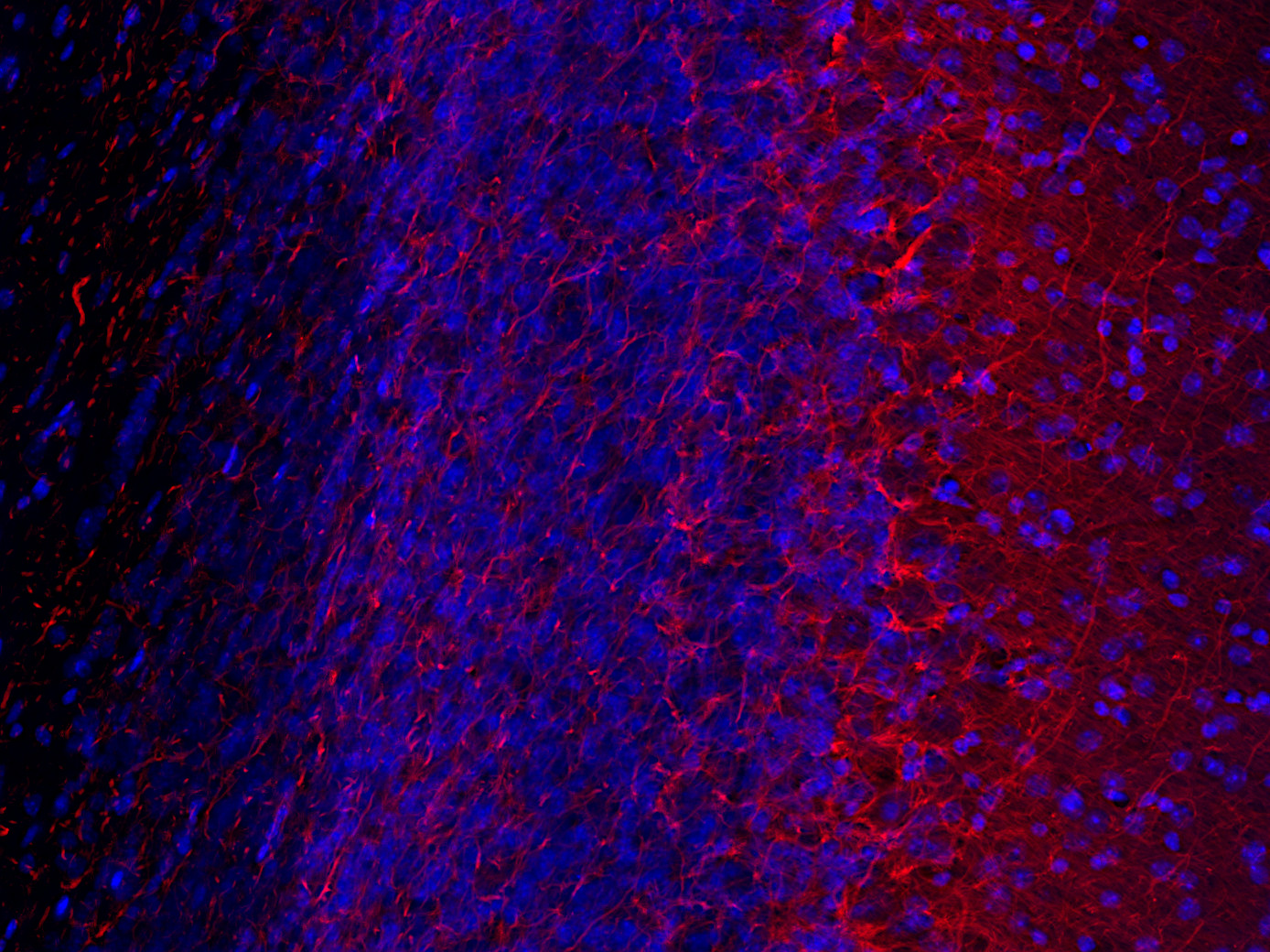 Neurofilament M Recombinant rabbit - image 5