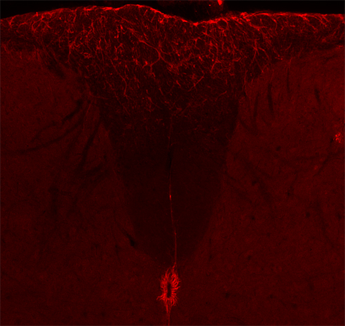 Vimentin Polyclonal rabbit antiserum - image 3