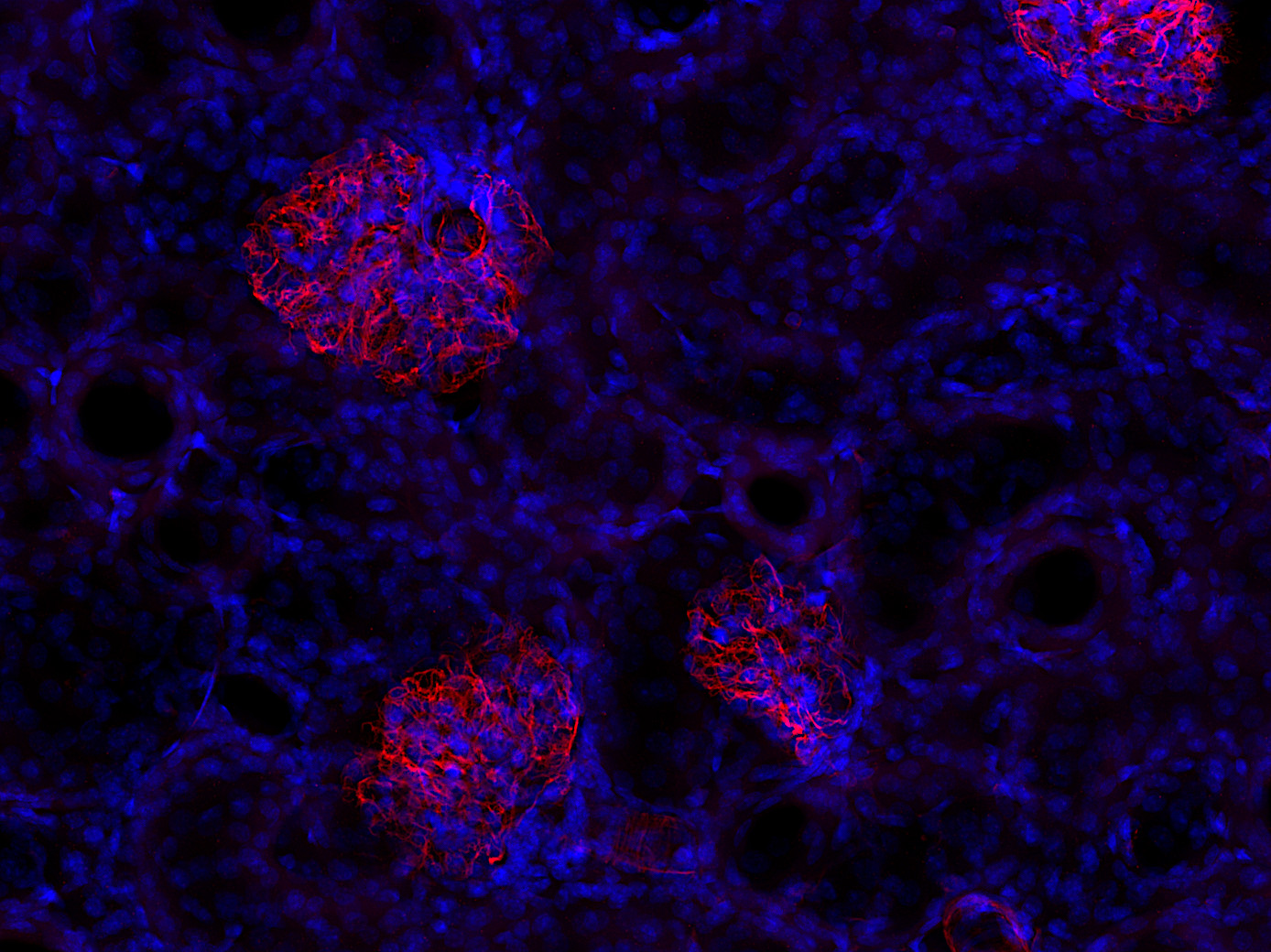 Vimentin, Polyclonal Guinea pig antiserum