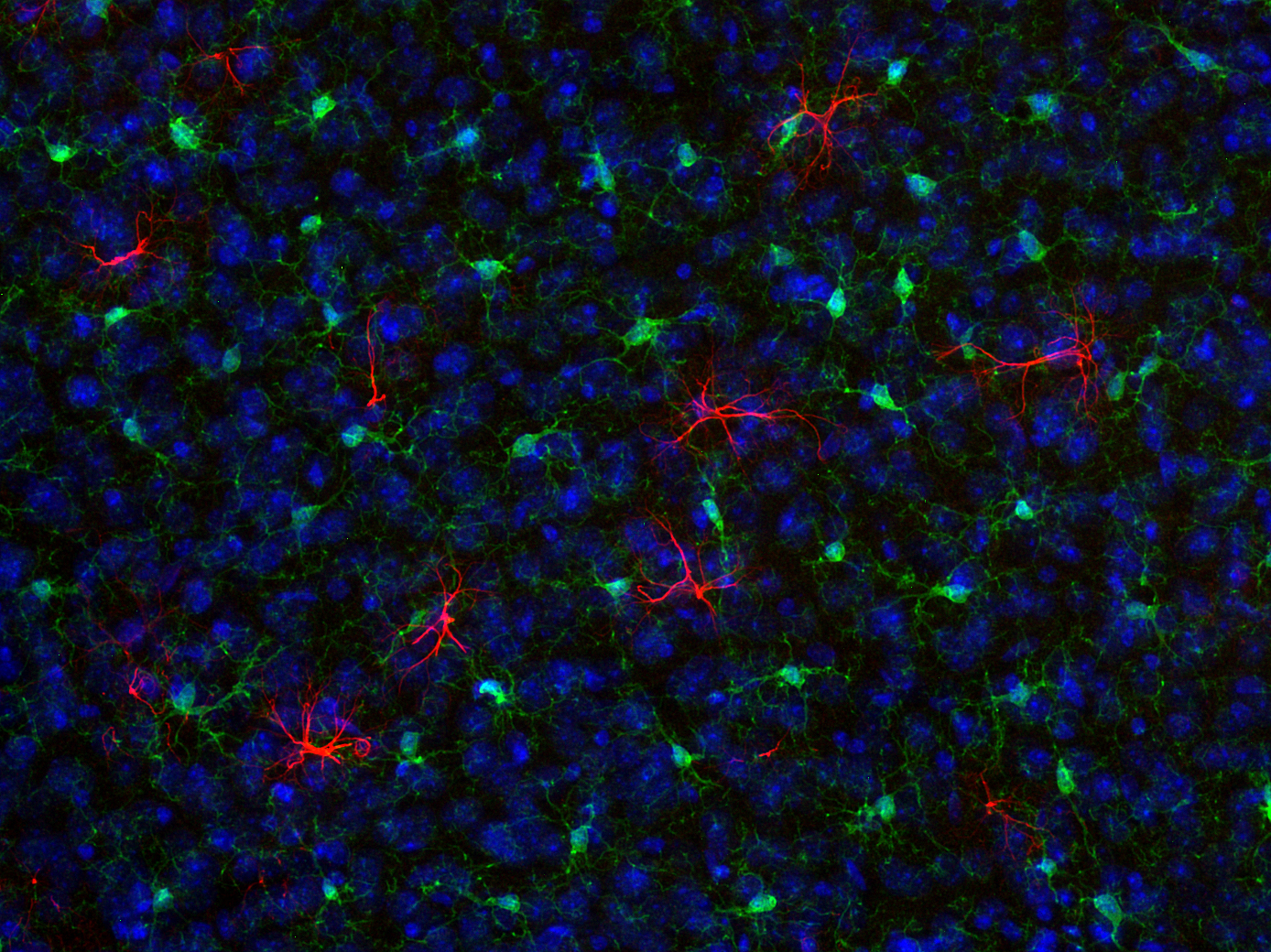 GFAP, Recombinant rabbit