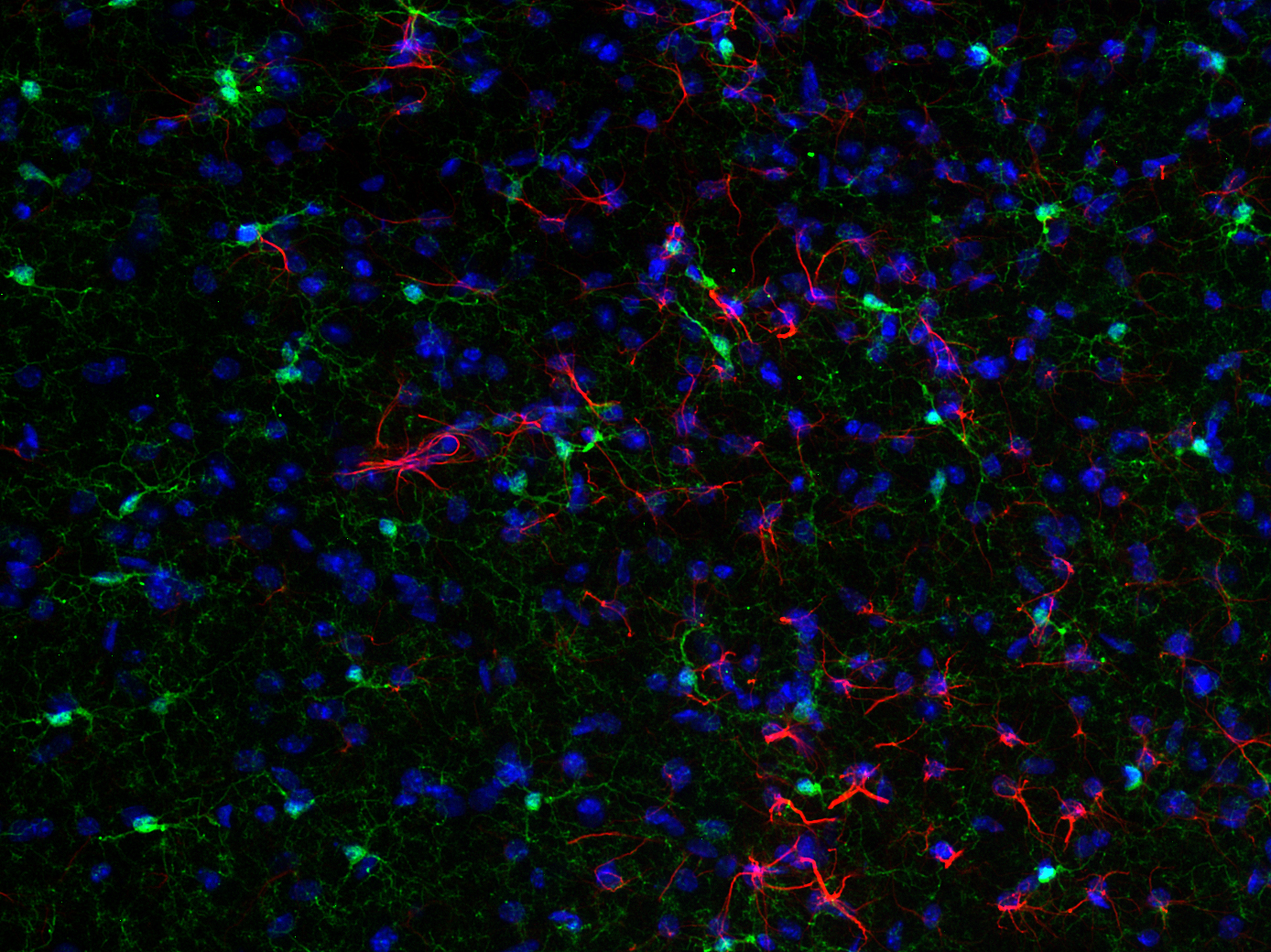 GFAP, Recombinant rabbit