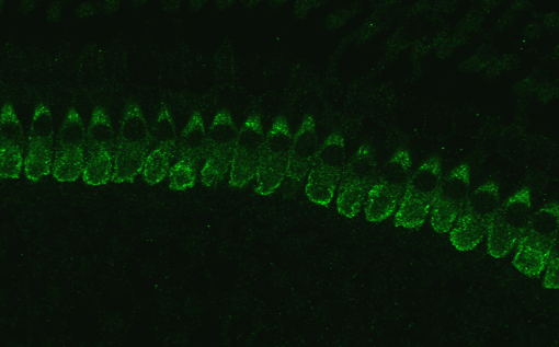 Otoferlin, Polyclonal rabbit purified antibody