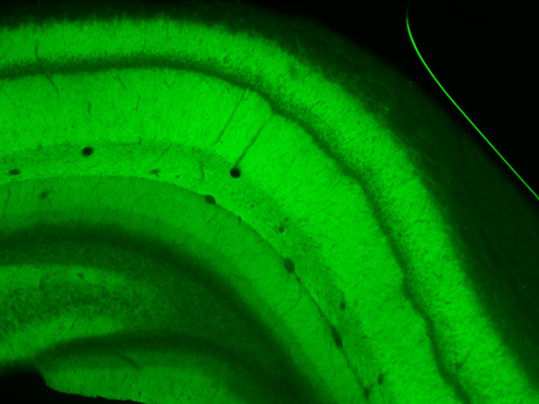 GluA Polyclonal rabbit purified antibody - image 2