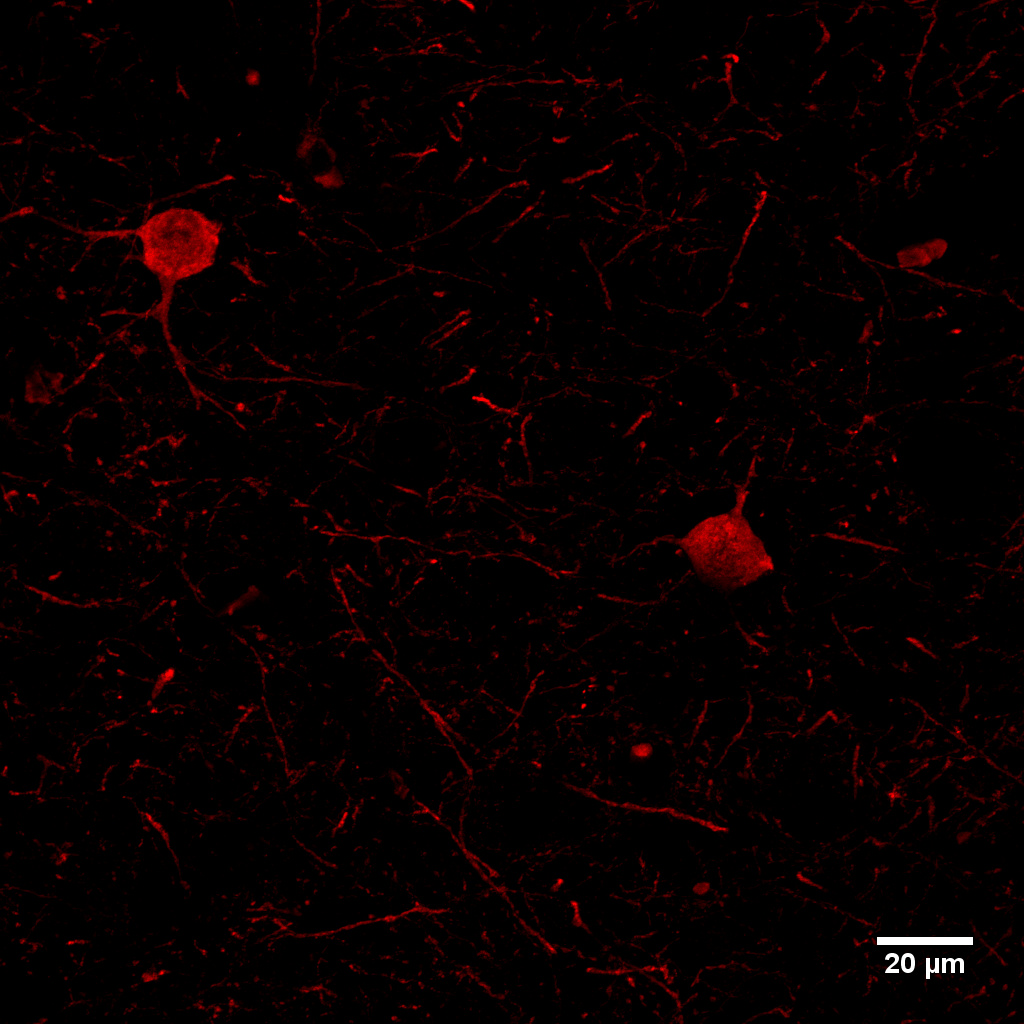 Parvalbumin, Polyclonal rabbit antiserum