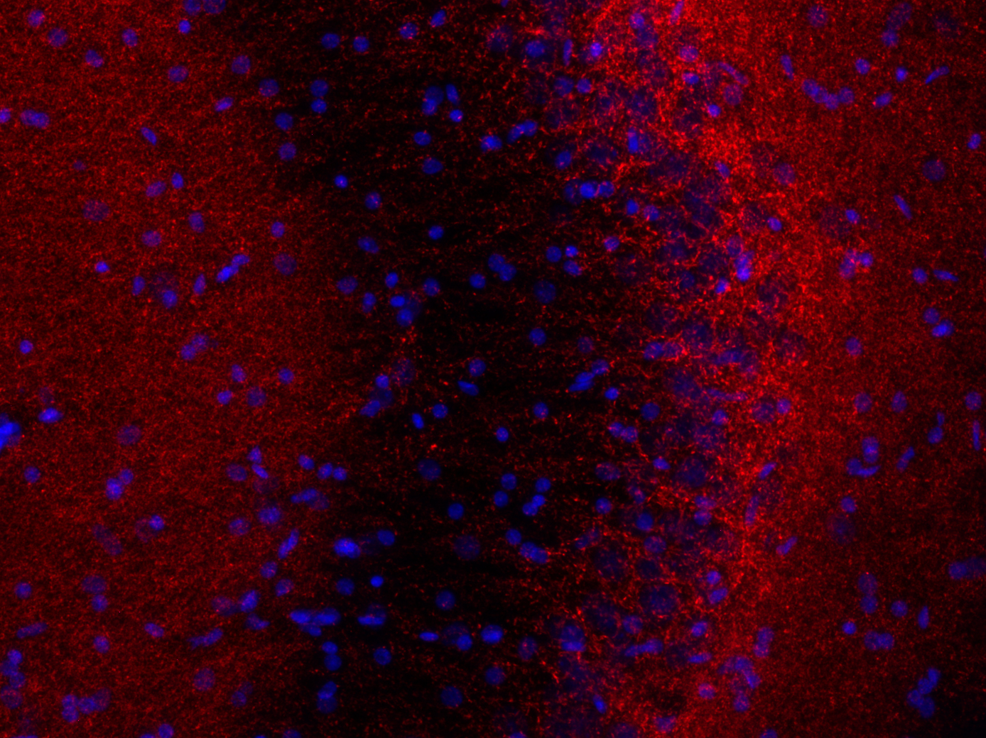 GAD2 / GAD65 Recombinant rabbit - image 3
