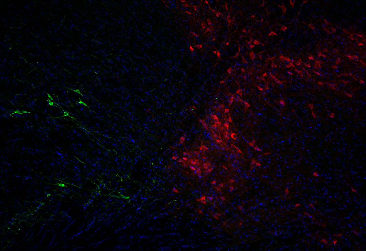 Tyrosine hydroxylase Recombinant rabbit - image 5