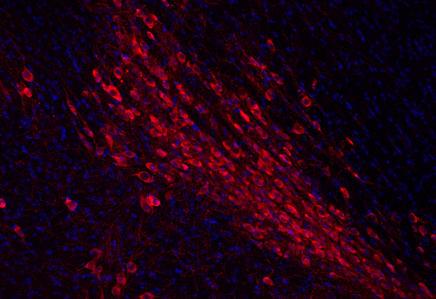 Tyrosine hydroxylase Recombinant Guinea pig - image 3