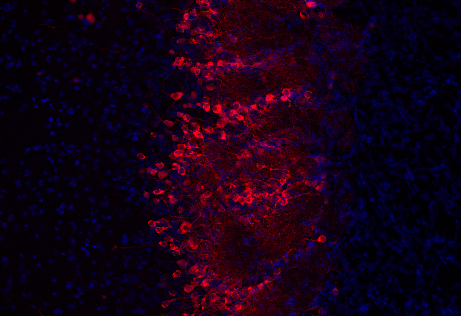 Tyrosine hydroxylase Recombinant Guinea pig - image 4