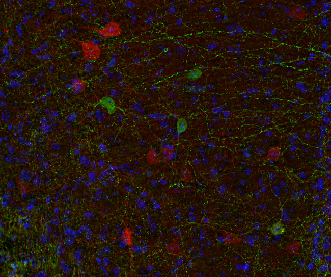 Calbindin D28k Polyclonal chicken IgY fraction - image 3