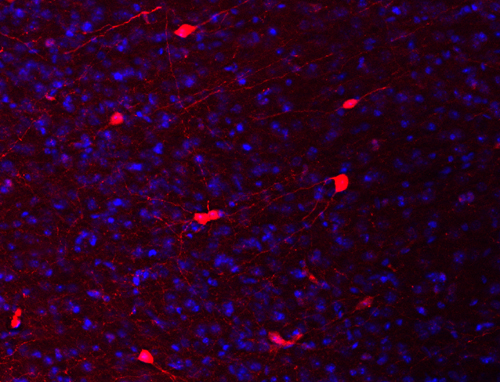Calretinin Polyclonal Guinea pig antiserum - image 3