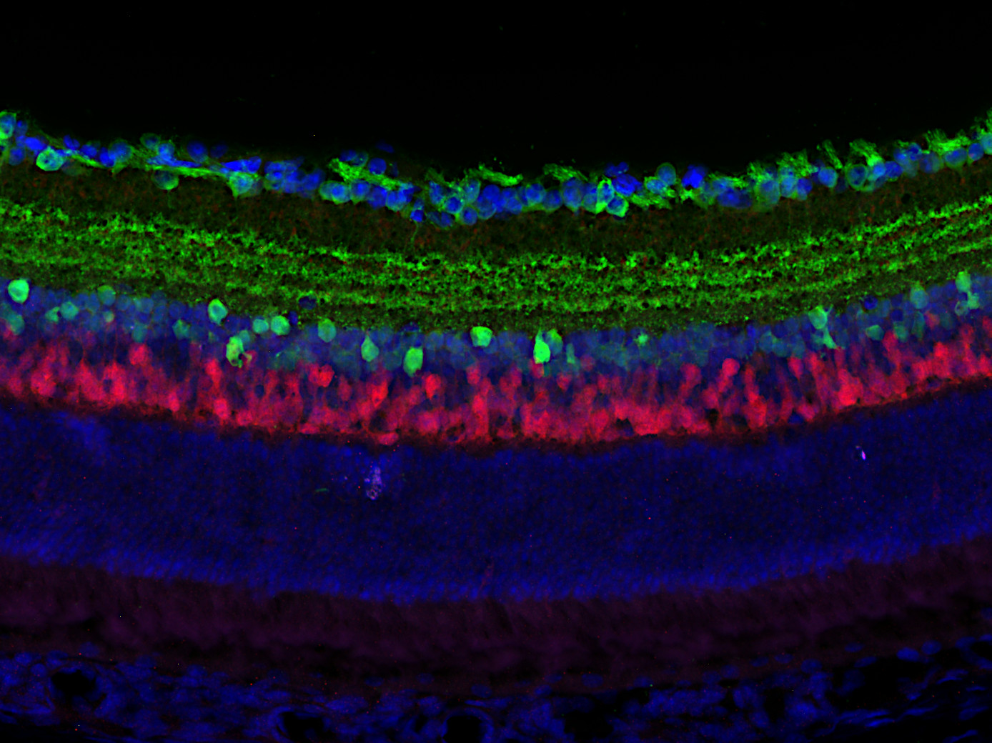 Calretinin Polyclonal Guinea pig antiserum - image 4