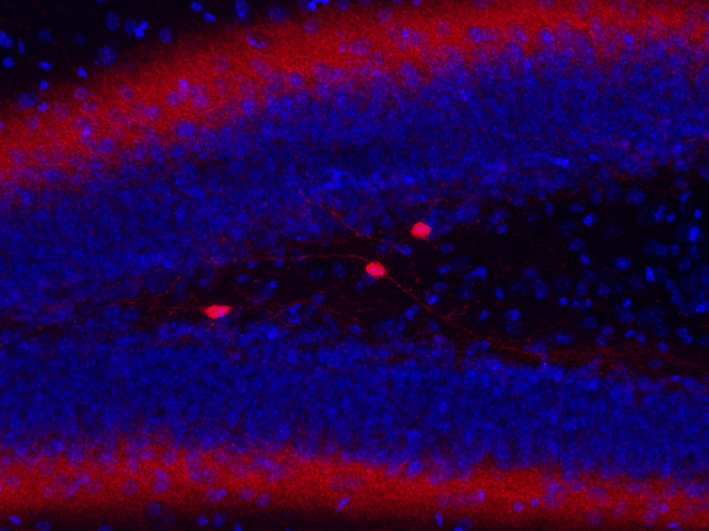Calretinin Recombinant rabbit - image 3