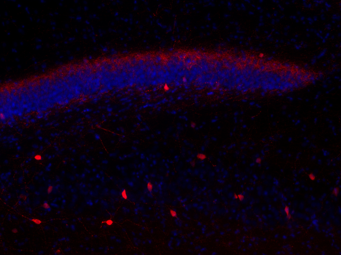 Calretinin Recombinant rabbit - image 4