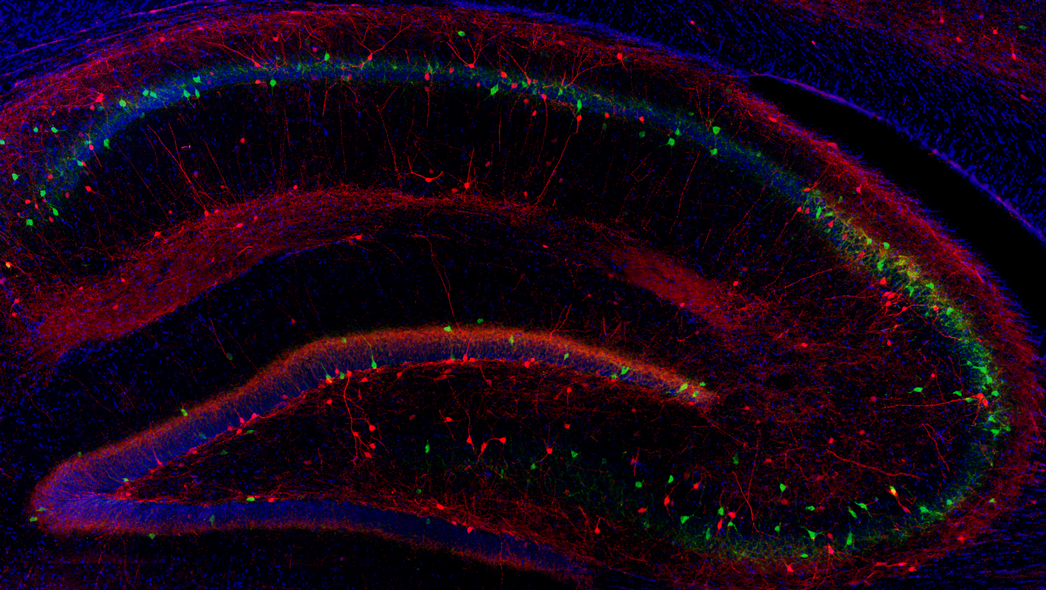 Calretinin Recombinant chicken - image 3