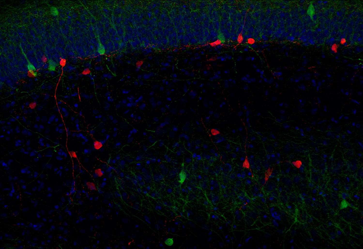 Calretinin Recombinant chicken - image 4