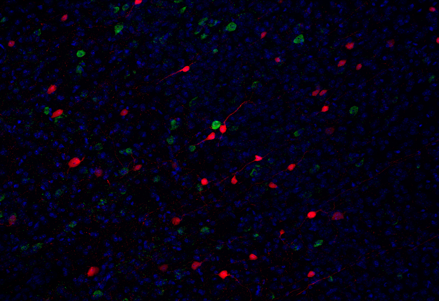Calretinin Recombinant chicken - image 5