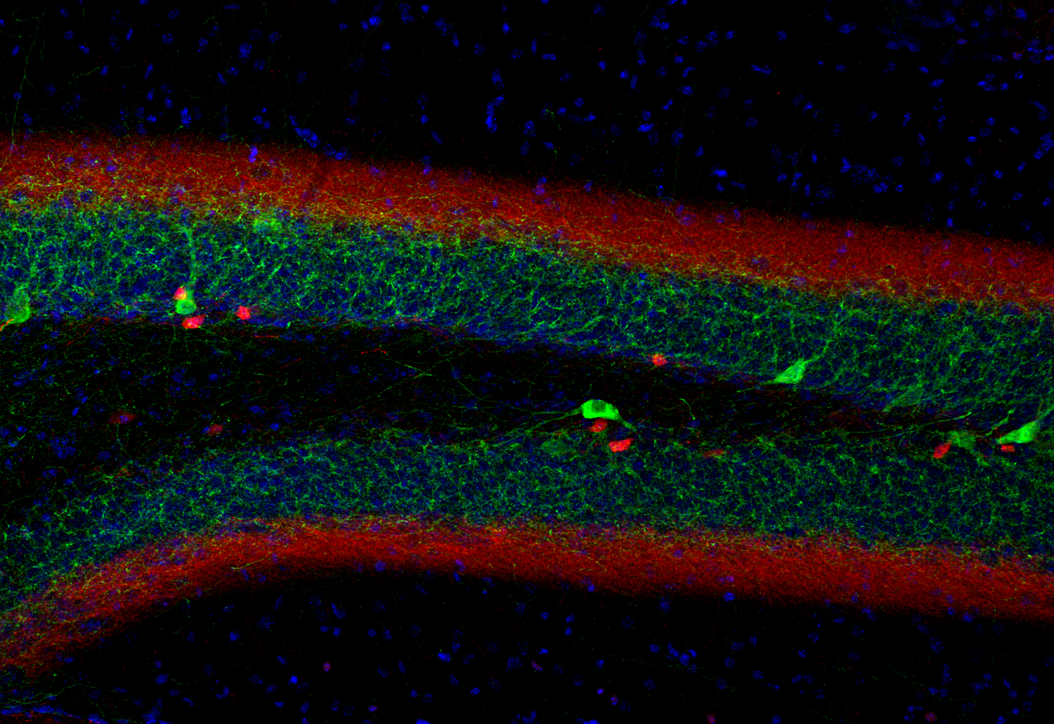 Calretinin Recombinant Guinea pig - image 3