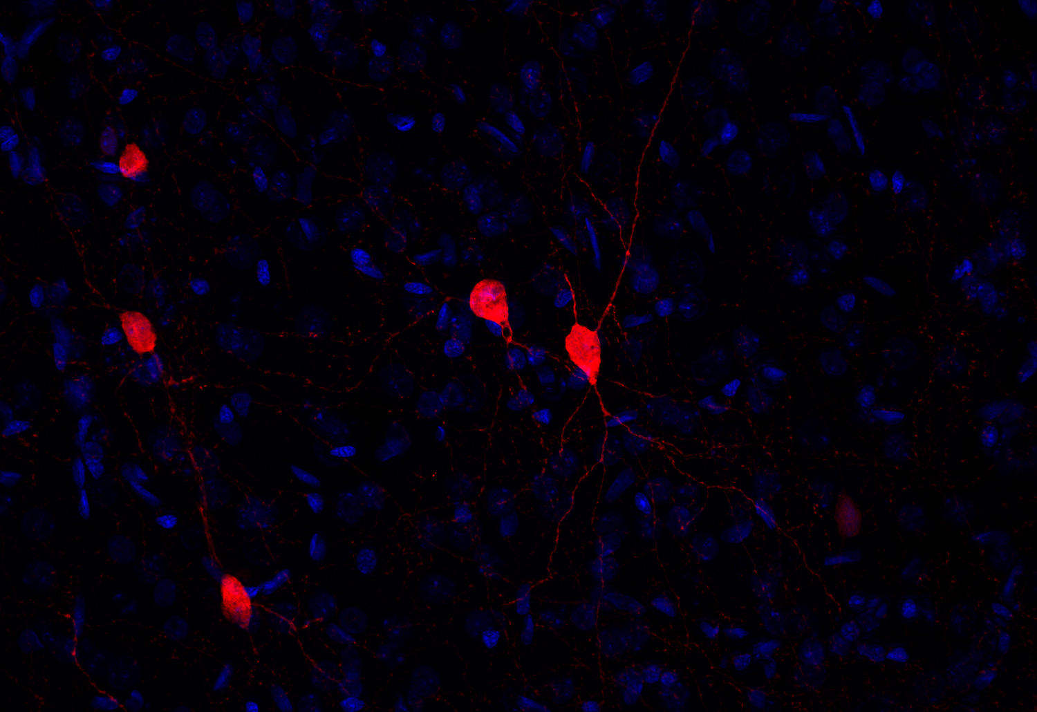 Calretinin Recombinant Guinea pig - image 4