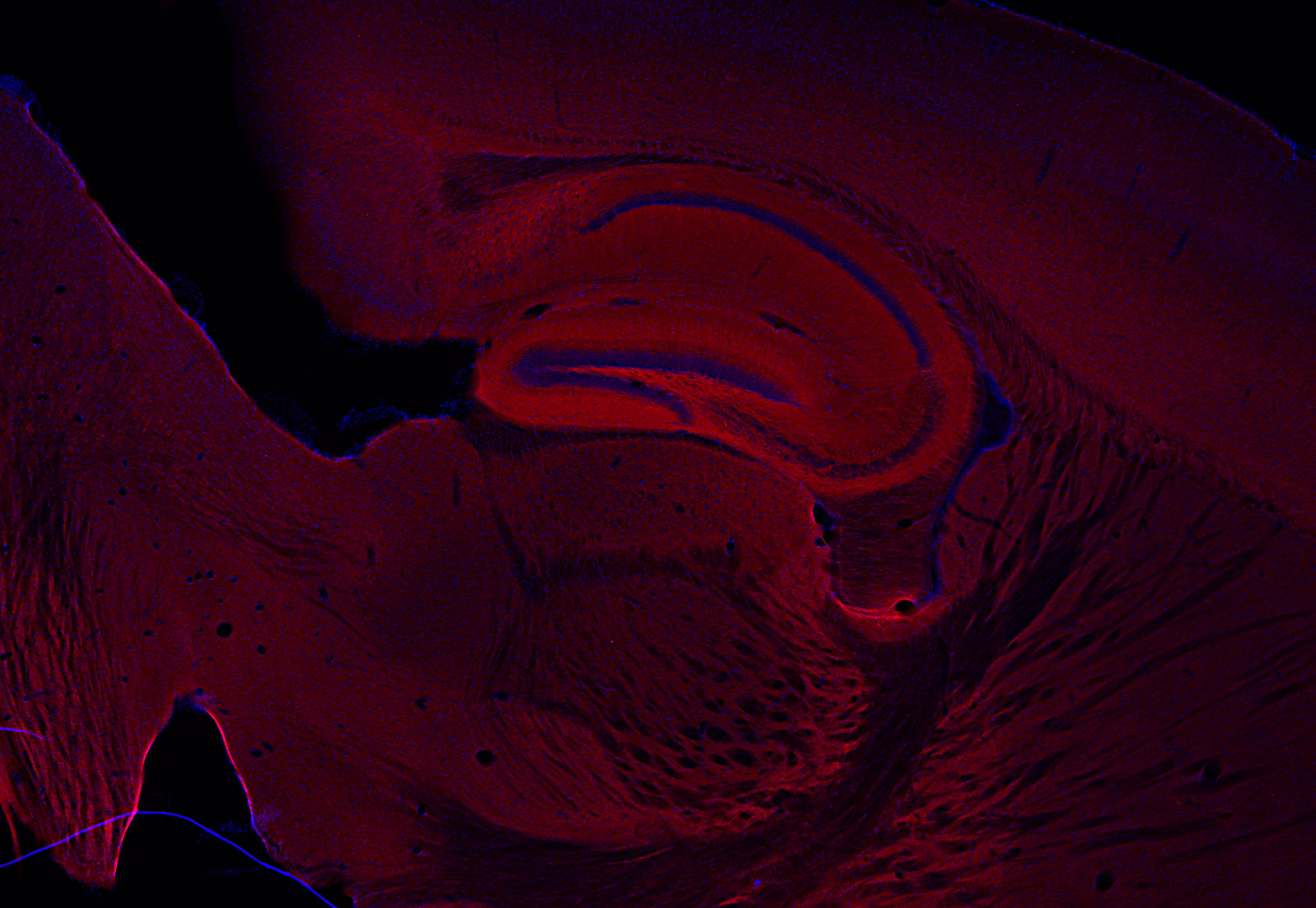 Tenascin-R Recombinant rabbit - image 4