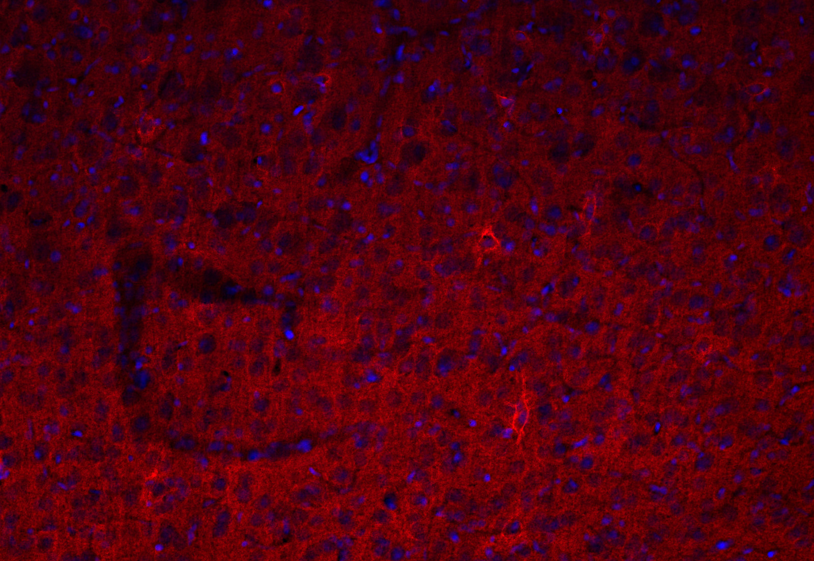 Tenascin-R Recombinant rabbit - image 5