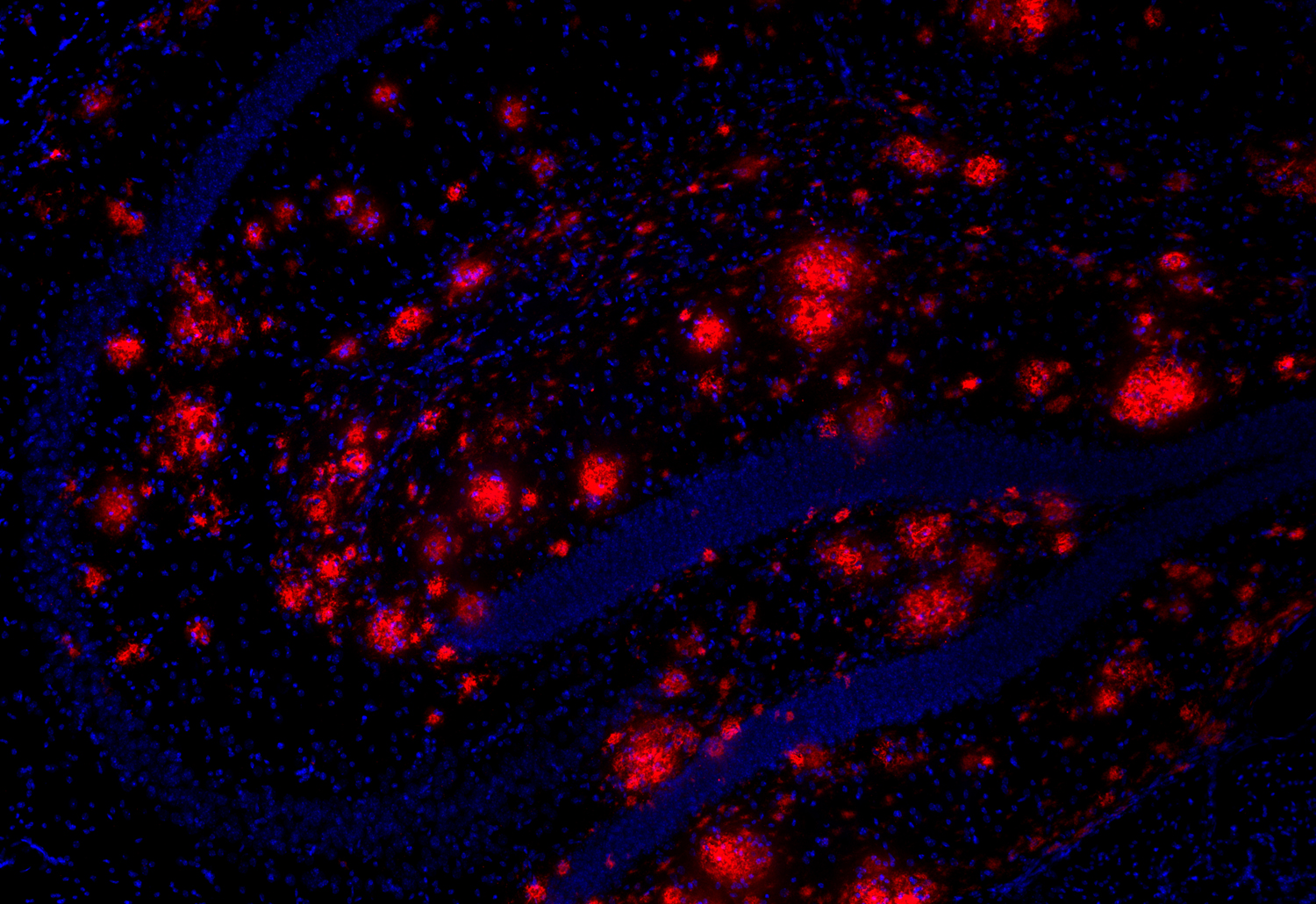 Abeta40, Recombinant rabbit
