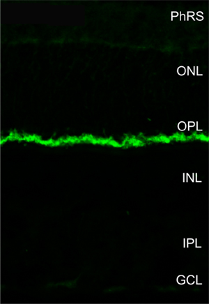 MPP4, Polyclonal rabbit purified antibody