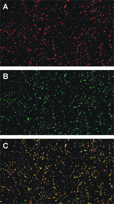 GABA-A receptor gamma2 Polyclonal rabbit purified antibody - image 3
