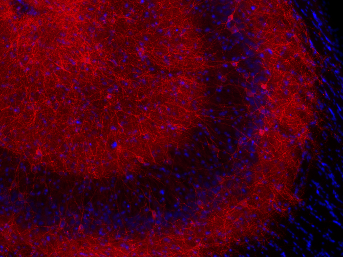 GABA-A receptor alpha1 Recombinant rabbit - image 4