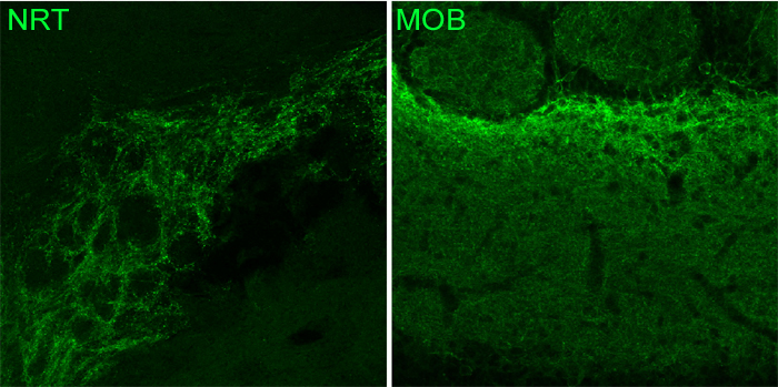 GABA-A receptor alpha3 Polyclonal Guinea pig antiserum - image 1
