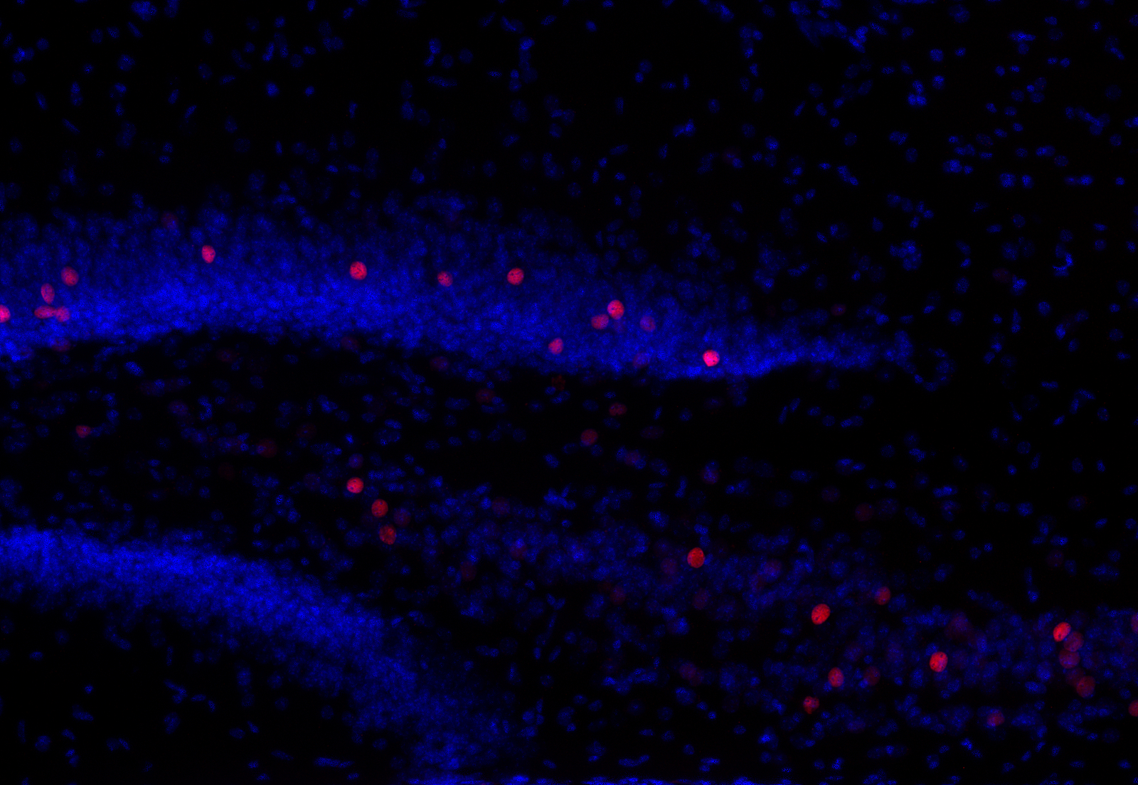 c-Fos Recombinant chicken - image 5