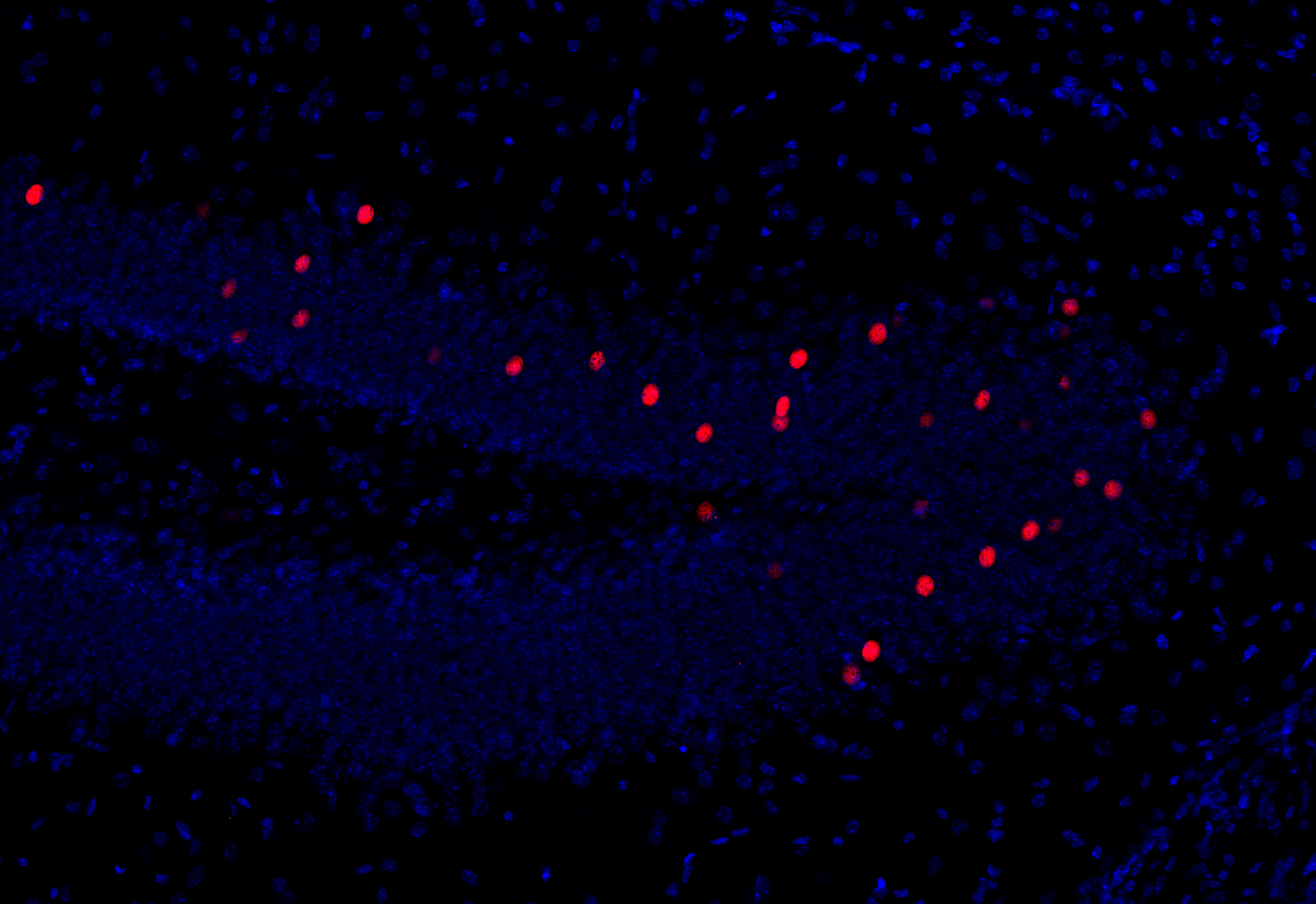 c-Fos, Recombinant human
