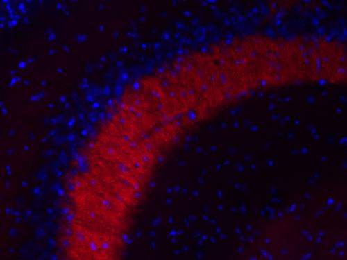 MAL2A, Polyclonal rabbit purified antibody