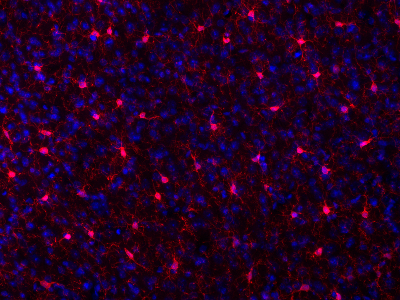 IBA1 Recombinant rabbit - image 3