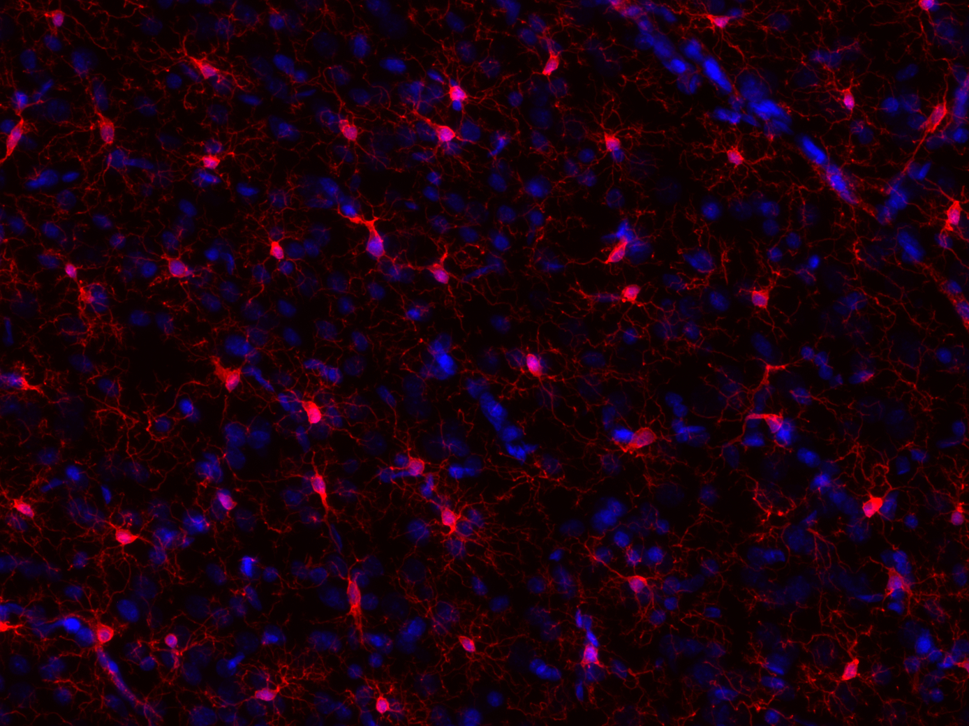 IBA1 Recombinant chicken - image 4