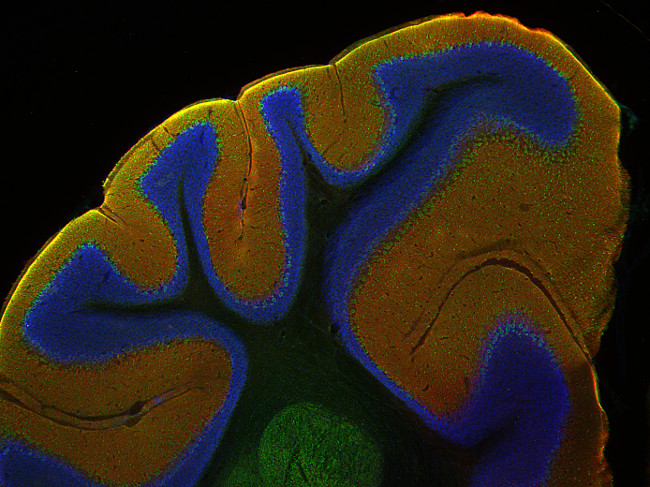EAAT1 Polyclonal Guinea pig antiserum - image 3