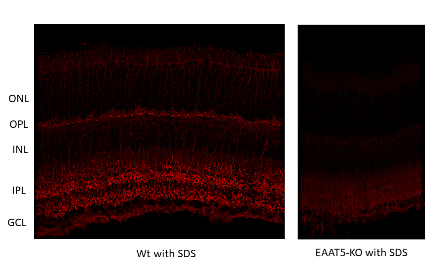 EAAT5, Polyclonal Guinea pig antiserum